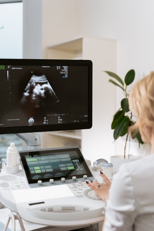 ultrazvuk miminko